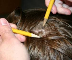 روش های پیشگیری و مبارزه با آلودگی شپش سر